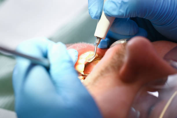 Best Broken or Chipped Tooth Repair in Creswell, OR