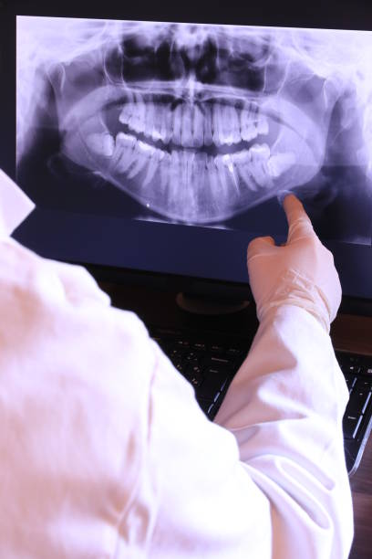 Best Dental Abscess Treatment in Creswell, OR
