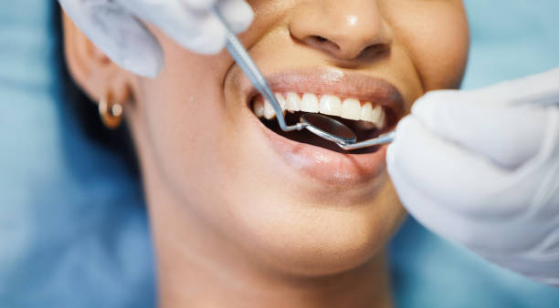 Best Emergency Denture Repair in Creswell, OR
